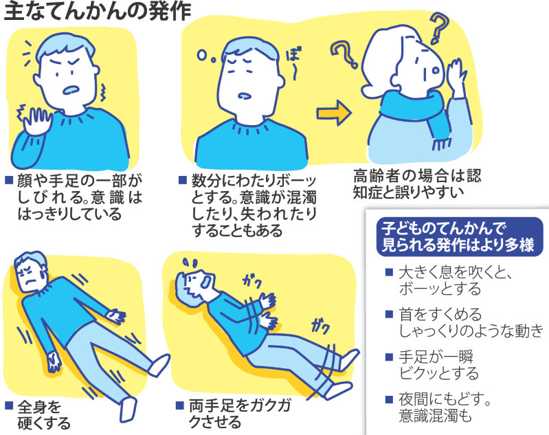 発作管理に関する一般的なヒント
