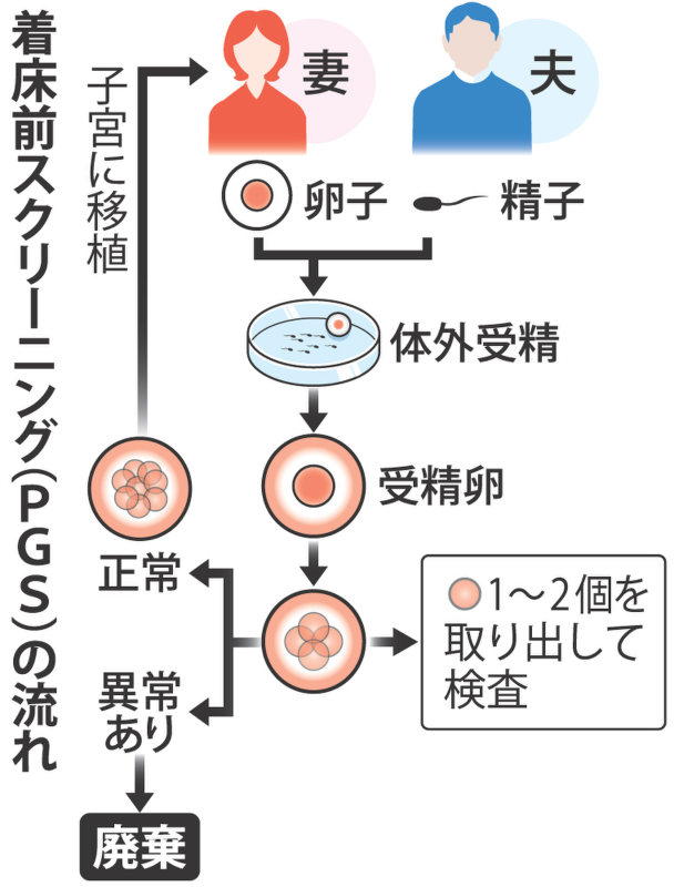 着床前スクリーニング(PGS)の流れ