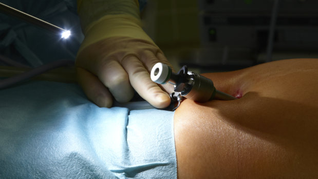 腹腔鏡手術、長短所見極めを 難易度高いほど医師の経験、技術で差