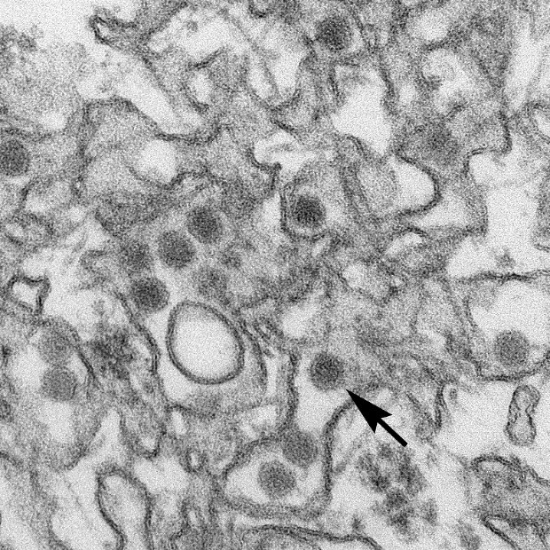ジカウイルスの電子顕微鏡写真=CDCウェブサイトより
