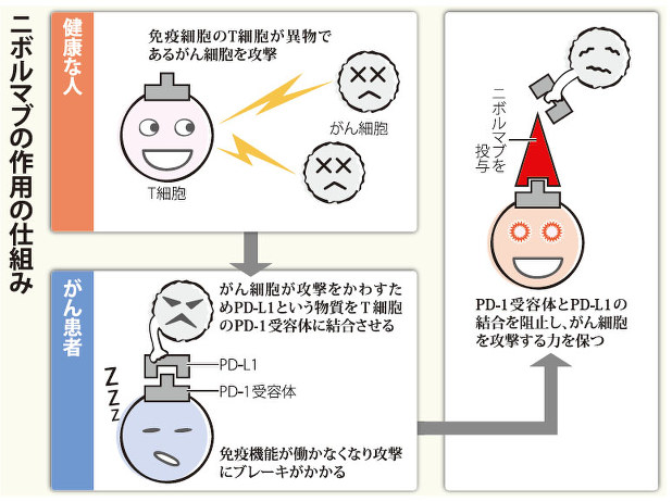 新作用のがん治療薬 体の免疫力を引き出す 紙面より 毎日新聞 医療プレミア