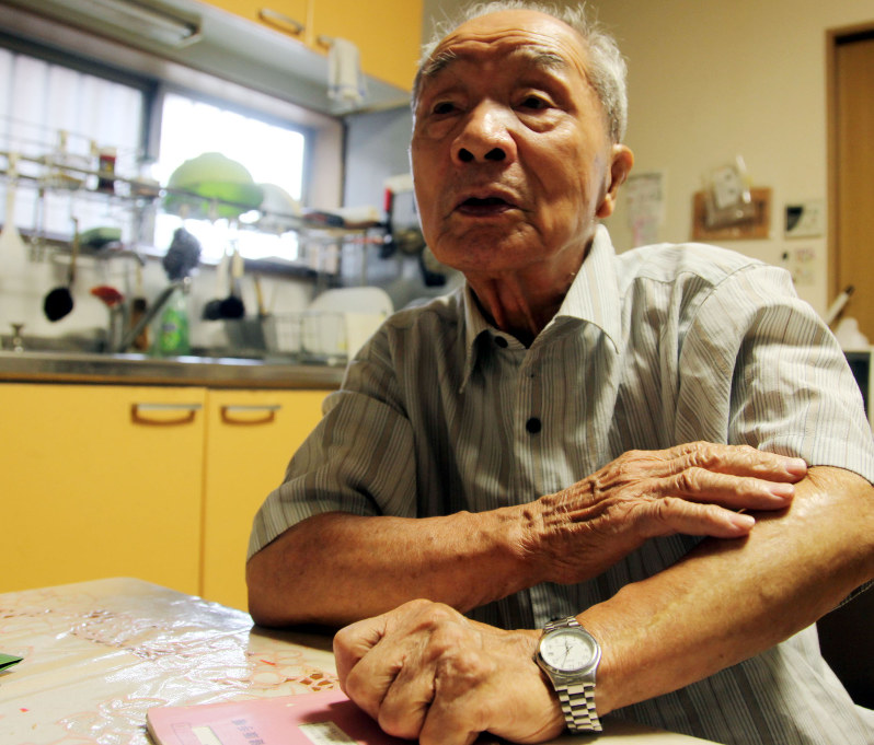 広島原爆によるケロイド痕に触れながら、思いを語る石橋恒さん=兵庫県尼崎市築地の自宅で撮影