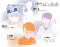 小林麻央さんの闘病記