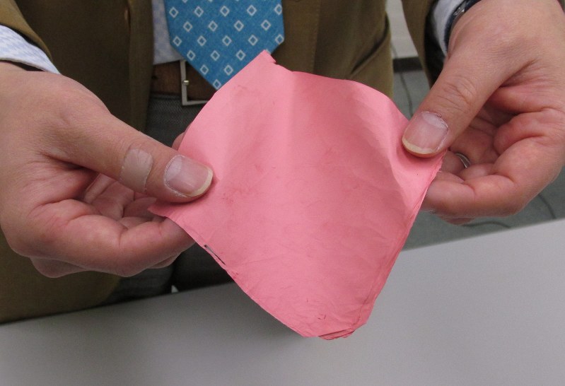 体内で分解されるプラスチックで作った治療用シート=茨城県つくば市で2017年2月27日、大場あい撮影