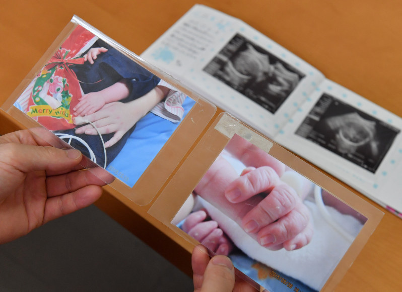 無痛分娩 夫 完全な人災 麻酔直後に医師不在 妻急変 毎日新聞