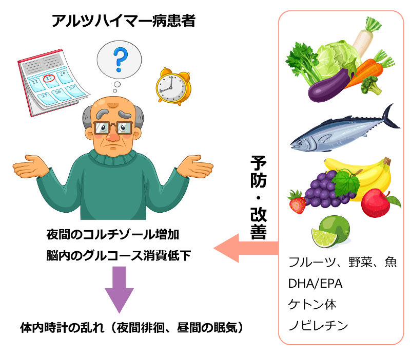 睡眠を改善する食事で認知症予防 生命の時計から考える健康生活 柴田重信 田原優 毎日新聞 医療プレミア