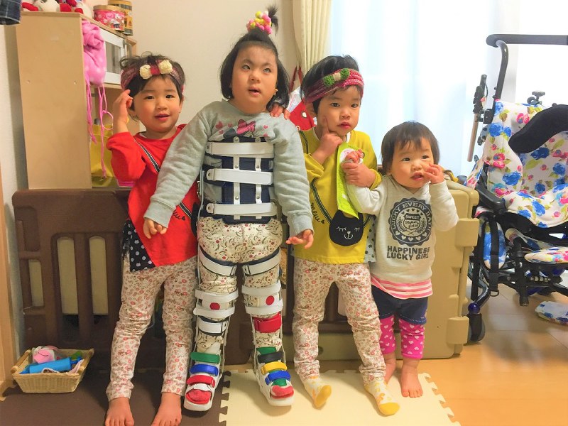 妹たちに囲まれる岸本心咲ちゃん(左から2人目)。装具をつけて立てるようになった=岸本さん提供