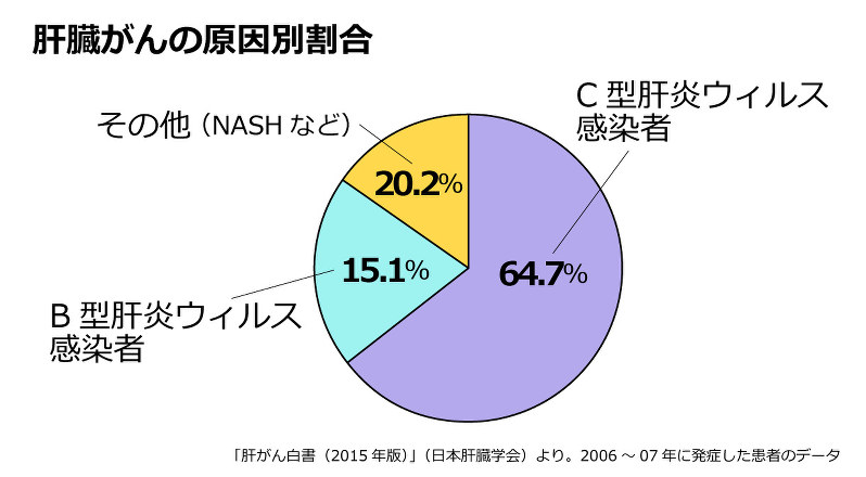 脂肪肝の進行放置で肝臓がんになる恐れも がんをあきらめない 難敵に挑む医師 患者 家族 福島安紀 毎日新聞 医療プレミア
