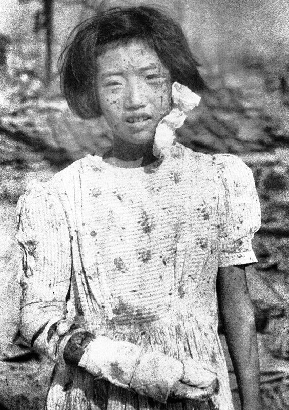 被爆3日後、国平幸男さんが撮影した少女=広島市で1945年8月9日