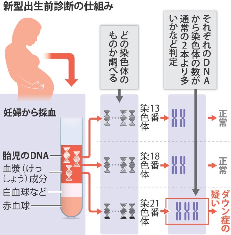 新型出生前診断の仕組み