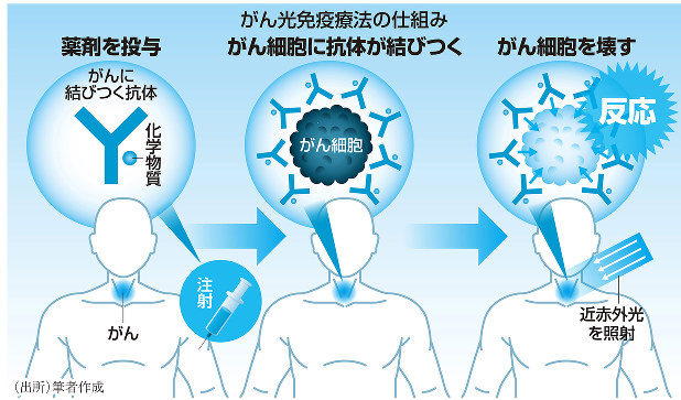 特集 頭頸部がん 光と薬でがん細胞を破壊 ベンチャーが治験開始 永山悦子 がんに勝つ薬 週刊エコノミスト Online