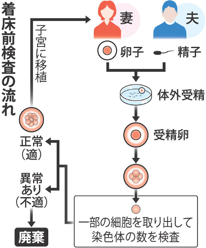 着床前検査の流れ