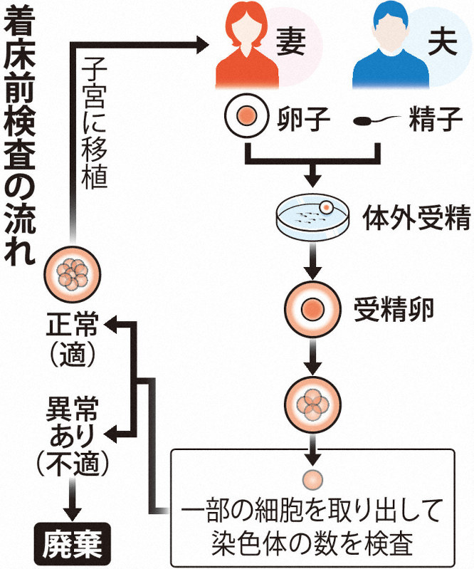 着床前検査の流れ