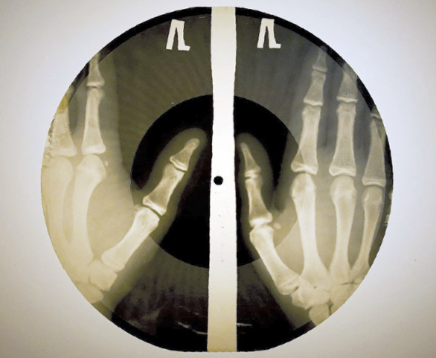 ボーン・レコード(C)The X-Ray Audio Project