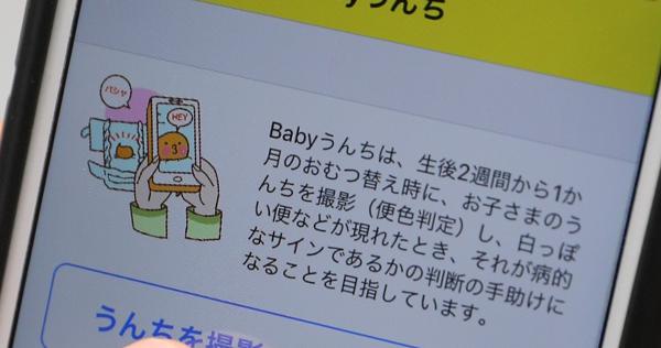 子育て親子 うんちアプリ で病気発見 毎日新聞