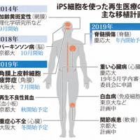 iPS細胞を使った再生医療の主な移植計画