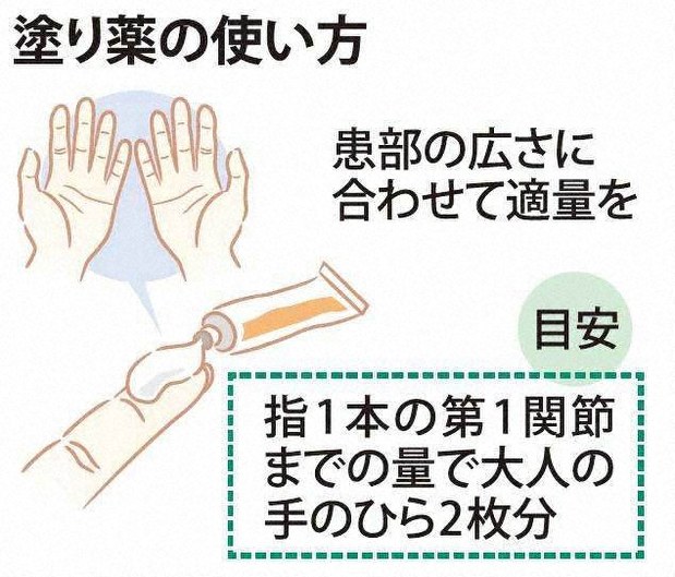 塗り薬や目薬の 今さら聞けない塗り方 さし方 あなたのおくすり手帳 高垣育 毎日新聞 医療プレミア