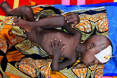 栄養失調患者に特化した「国境なき医師団」の小児集中治療室で、治療を受ける国内避難民のモハメッド・ブカルちゃん（3）。母ビントゥさん（30）は前日入院したモハメッドちゃんの傍らを片時も離れず世話をしていた＝ナイジェリア・ボルノ州マイドゥグリで2019年9月30日、山崎一輝撮影