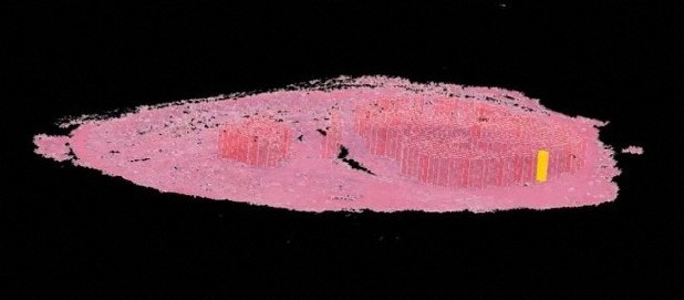 がん組織の病理画像。がんの特徴(色の濃い部分)を人工知能(AI)がディープラーニングで自ら見つけ出した=理化学研究所提供
