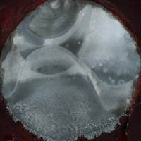 Metal deposition is seen formed on the negative electrode made of an unprocessed zinc plate in an experimental zinc-nickel battery after the cell was repeatedly charged and discharged. (Photo courtesy of Doshisha University professor Masatsugu Morimitsu)