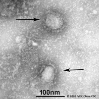 透過型電子顕微鏡でとらえた新型コロナウイルス＝GISAID　Initiative提供
