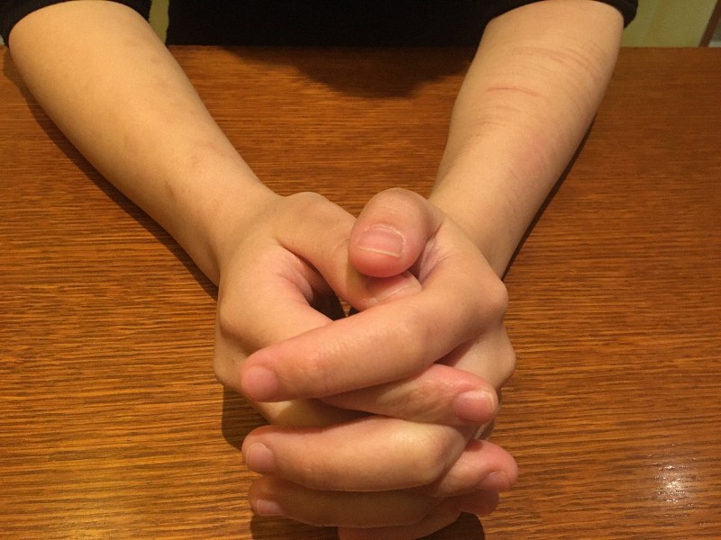 父親からの性的虐待について語る女性。腕にはリストカットの痕が残る=東京都内で2020年2月17日午後5時5分、椋田佳代撮影