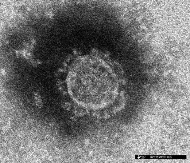 国立感染症研究所が分離した新型コロナウイルスの電子顕微鏡写真=同研究所提供