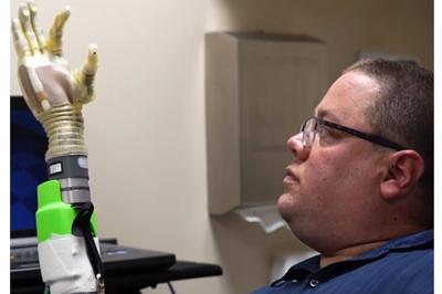 ロボット義手の研究に参加したジョー・ハミルトンさん（ミシガン大提供）