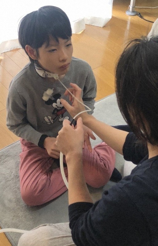 自宅で母親の浜本春華さんに、たんを吸引してもらう優慈さん=春華さん提供