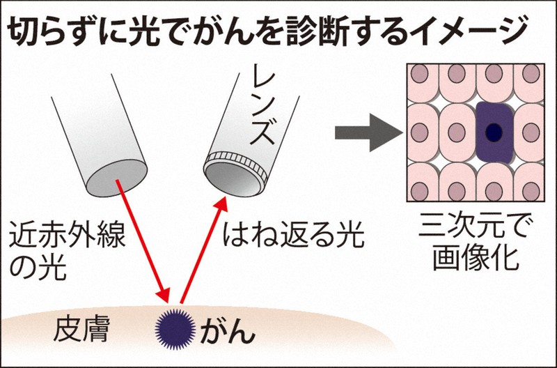 切らずに光でがん診断を診断するイメージ