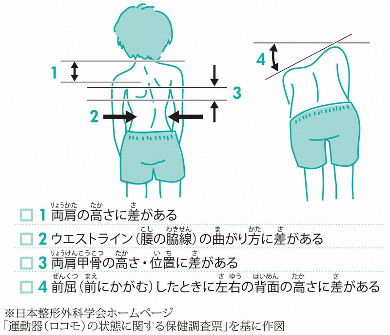 子どもの姿勢運動発達 早期診断/早期治療への道 写真と図から学ぶ赤ちゃんの姿勢運動発達 | 家森百合子, 吉田菜穂子