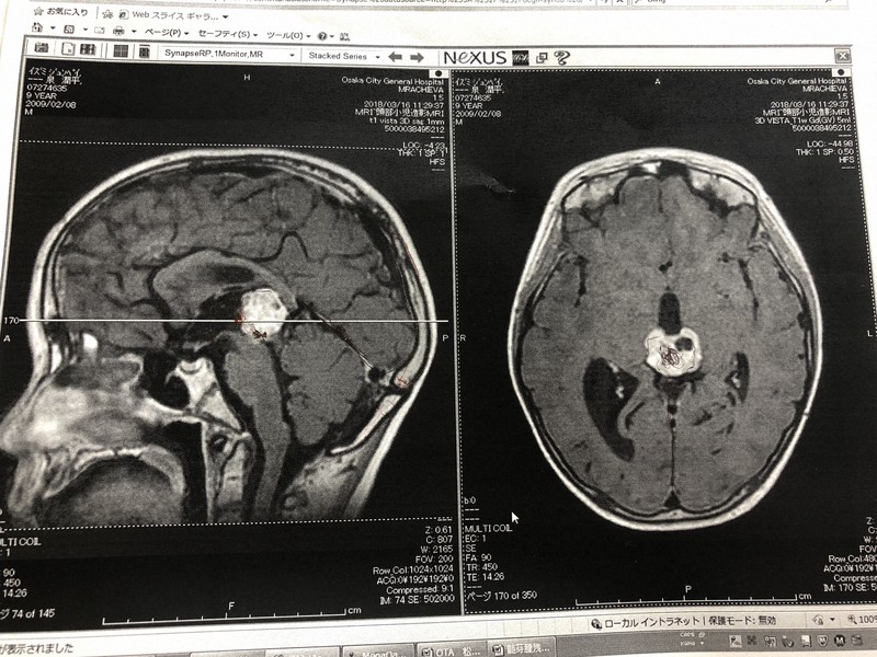 ぼくもここに入院していました 小児がんの子供たちに 小さなサンタ の贈り物 毎日新聞