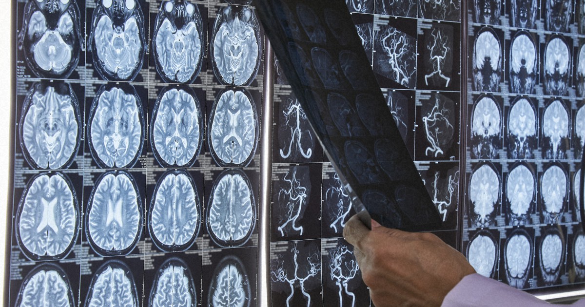 3ページ目 嵐が発表した ジャニー喜多川さん緊急搬送 くも膜下出血を引き起こす 時限爆弾 とは 文春オンライン