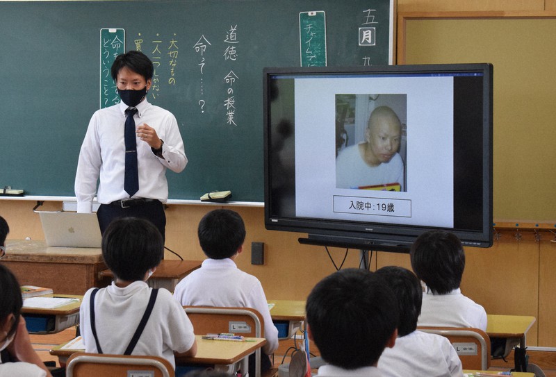 今ある命を大事に 18歳で白血病を患った教師が10年続ける授業 毎日新聞