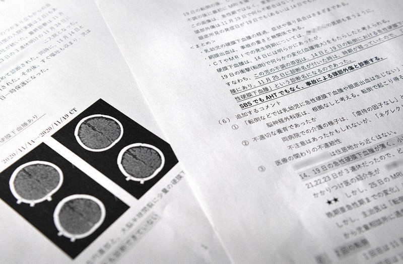 両親が依頼した脳神経外科医がまとめた意見書。「事故による頭部外傷」とし、最初の転倒による急性硬膜下血腫が見逃されたことを指摘している(画像の一部を加工しています)
