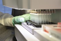 アルツハイマー病の治療薬「アデュカヌマブ」を研究する米製薬会社バイオジェンの研究員＝2019年、AP・バイオジェン提供