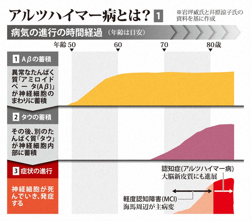 新薬誕生のアルツハイマー病 原因 治療研究の長い道のりひもとく 毎日新聞