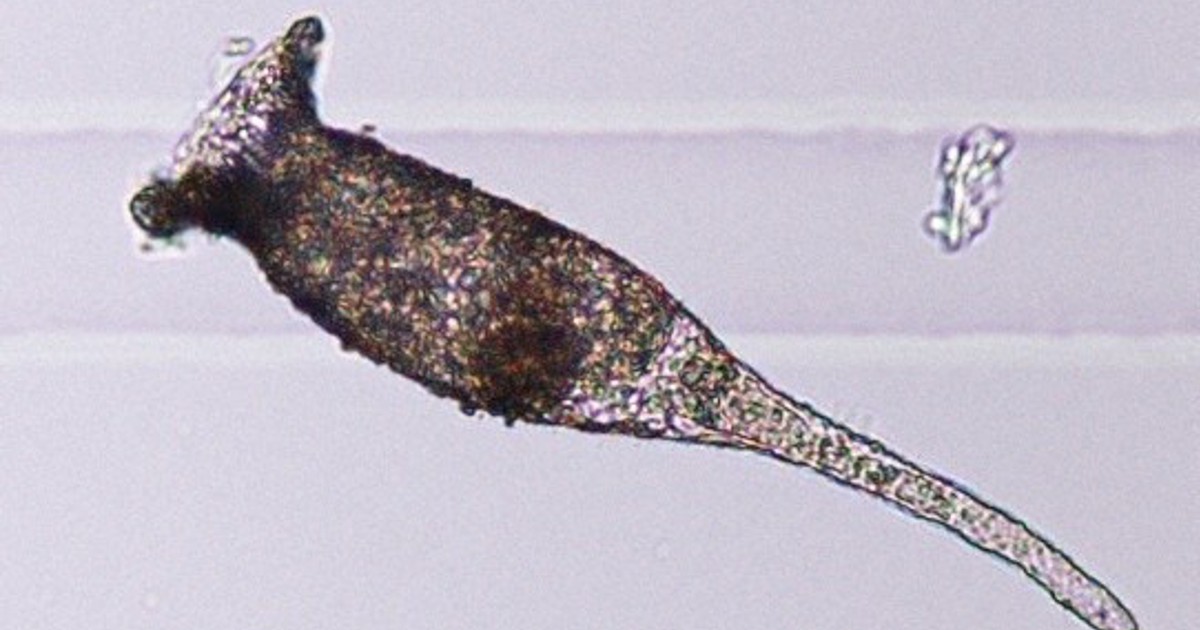 幻の原生動物 ビワコツボカムリ 103年ぶりに新種登録 滋賀 毎日新聞