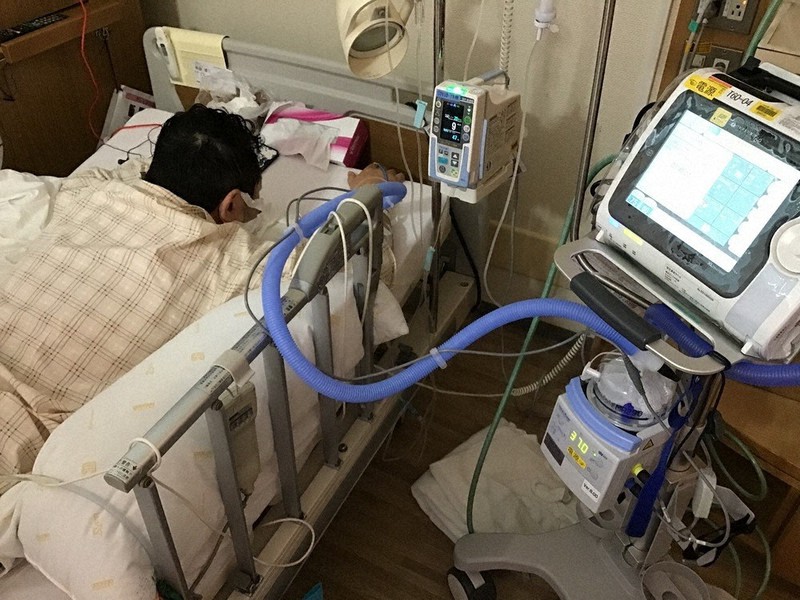 川崎市立多摩病院で、「ネーザルハイフロー」を装着し高流量の酸素を吸入している男性患者=8月16日撮影(同病院提供)