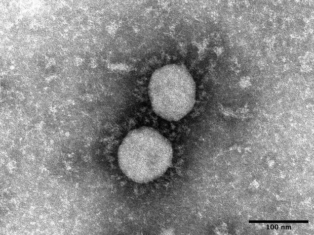 Research In Japan Helps Reveal What Long Lasting Covid Protection Vaccines Offer The Mainichi