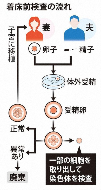 着床前検査の流れ