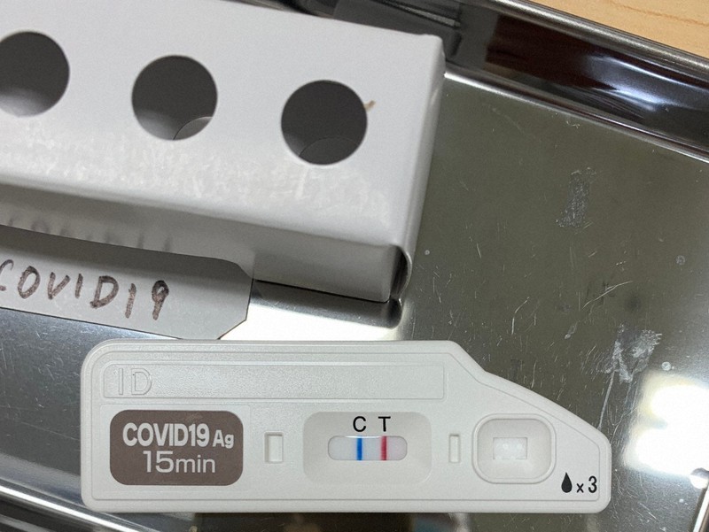 Coronavirus slips through antigen test at hospital in Japan's Nara Pref., infects staff The