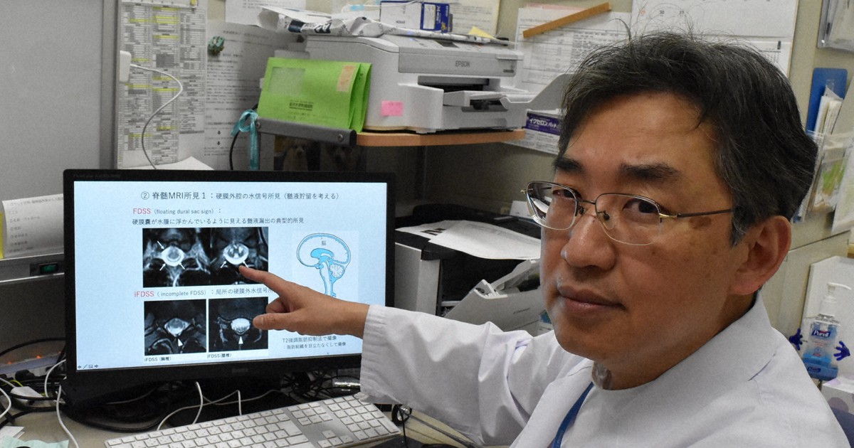 最後の院に選ばれる不定愁訴完全制覇テクニック　脳脊髄液循環の新発見 脳脊髄液容量が経年によって増えることが初めて明らかに MRI画像