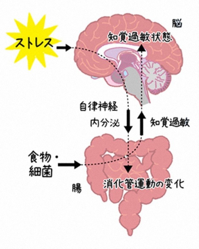 ストレスや生活・食習慣などが過敏性腸症候群の発症に影響することを示したイメージ図=日本消化器病学会ホームページの市民向けガイドより