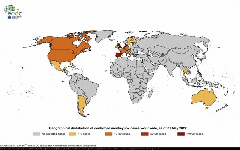 ヨーロッパや南北アメリカ、オーストラリアなどの、モンキーポックスの感染者数を示す地図。欧州疾病予防管理センター(ECDC)が2022年5月31日現在でまとめた。最も濃い色(英国やスペインに塗られた色)は感染者が100人以上であることを示し、黄色は感染者1~9人を示す。地図に示された感染者数の合計は557人=ECDCのウェブサイトから