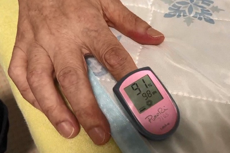 男性のパルスオキシメーターの数値は呼吸不全の可能性がある91%を示していた=東京都品川区で2022年7月28日(田代院長提供)