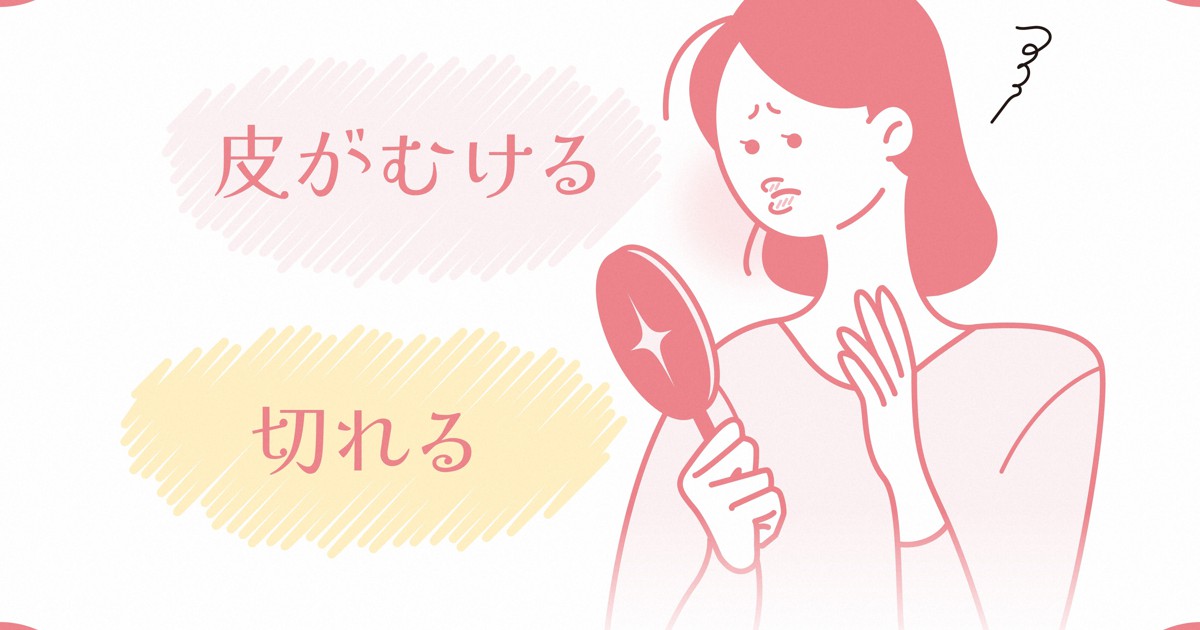 唇が乾いてヒリヒリ 荒れの原因と対処法は 毎日新聞