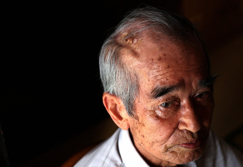 eye：78年前の地獄 血は今も | 毎日新聞