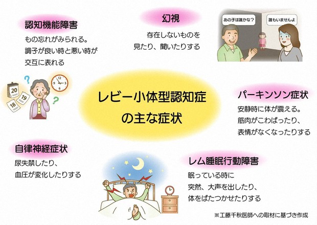 レビー小体型認知症 発見者の小阪憲司先生からの「宿題」 | 脳と心の
