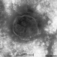 麻疹ウイルスの画像＝東京都健康安全研究センター提供